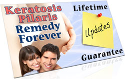 Lifetime Updates Guarantee